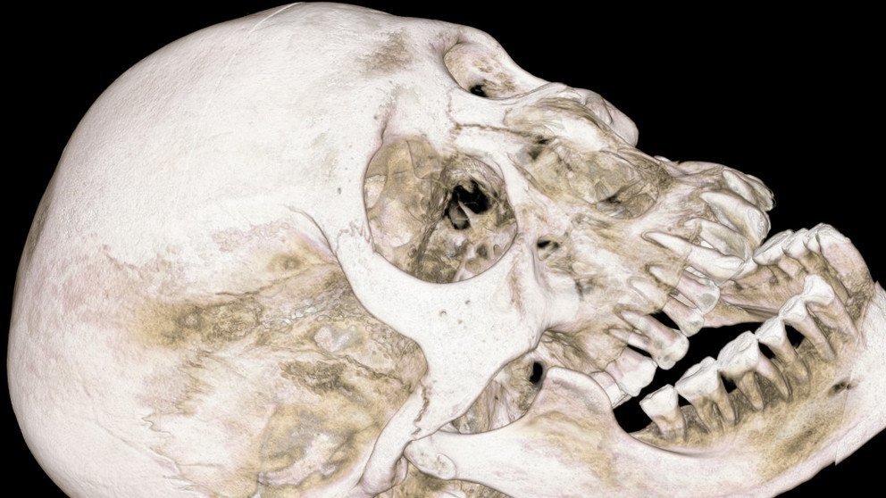 Sch&auml;del Symbolbild