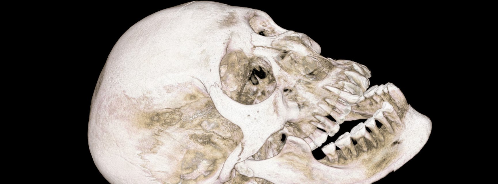 Sch&auml;del Symbolbild